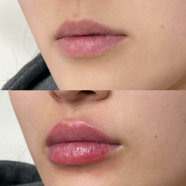 Lippenfüller mit Vitamin E - natürliches Serum - schnelle Wirkung & langanhaltend Online – Bild 4