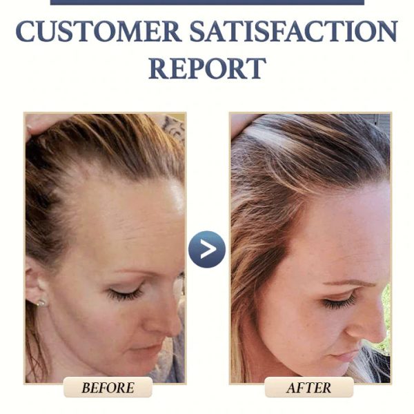 1+1 GRATIS | OriginGROWTH | Reis Haarwuchs Shampoo Bar Mode – Bild 4